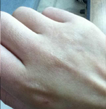 脸第十期：秋冬护手困扰CQ9电子网站救救我的(图2)